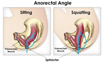 Anorectal Angle